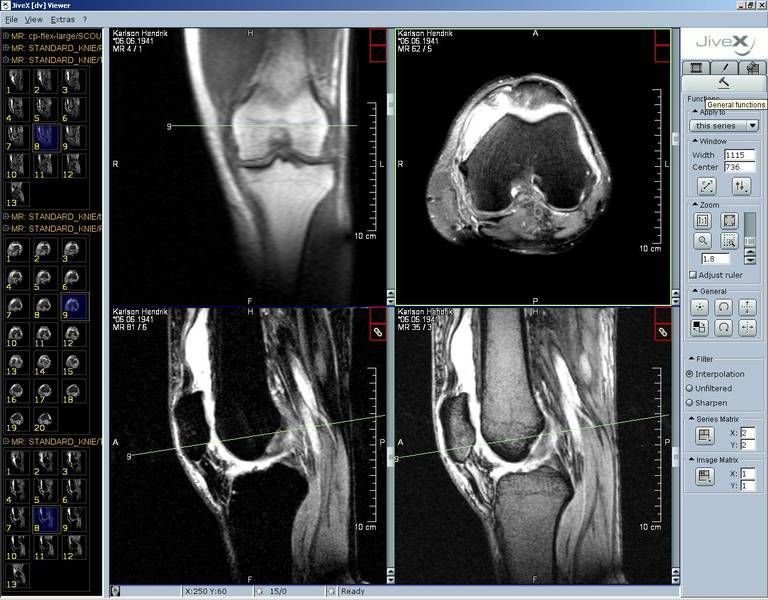 dicom viewer gratuit